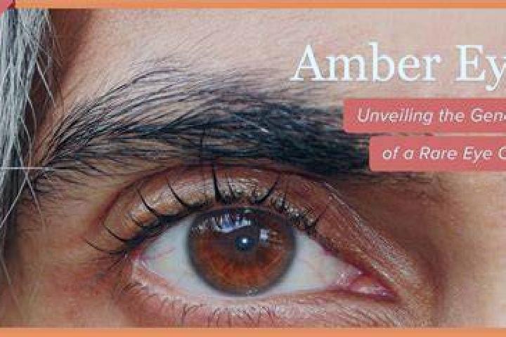 escort Olzai