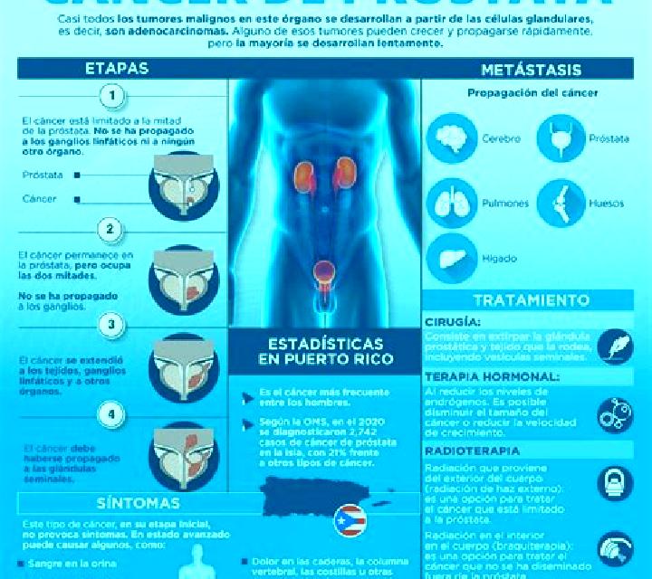 Giulia, 33, acompañante pelirroja de ojos oscuros y etnia caribeña basada en Funtua. Ofrece Masaje erótico, Experiencia de novia, GFE (Experiencia de novia),...