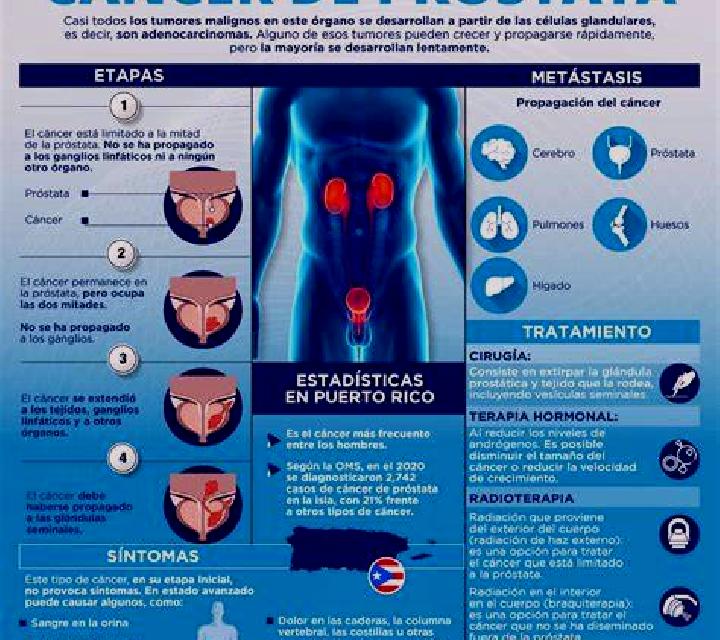 Lucía, 32, acompañante castaña de ojos grises y etnia mediterránea basada en Molde. Ofrece Noche completa, Striptease, Masaje de próstata. Disponible en domi...